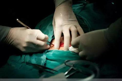 女人分娩视频过程